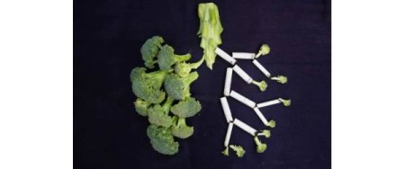 Κυστική ίνωση: Τα “αθώα” συμπτώματα και τι να περιμένεις